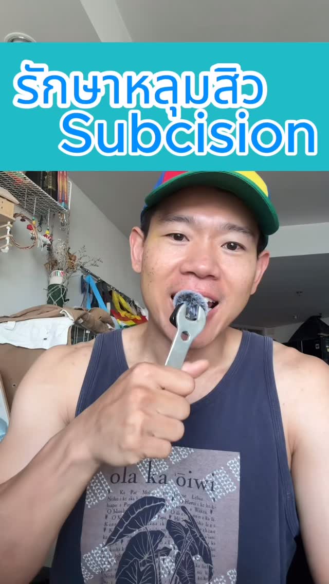 ทำหน้าหลุมสิว Subcision
